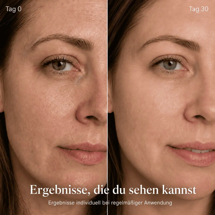 Glow One – Rotlichttherapie für Gesicht & Hals - Bild 8