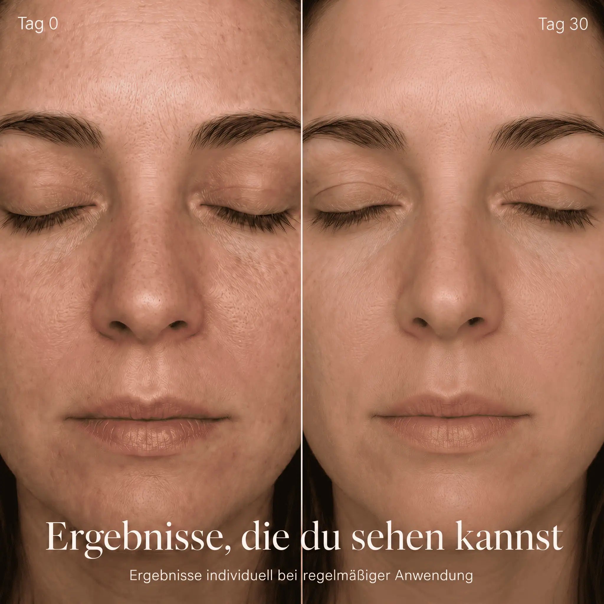 Glow One – Rotlichttherapie für Gesicht & Hals
