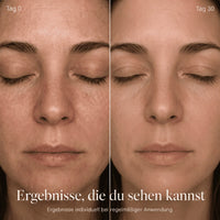 Glow One – Rotlichttherapie für Gesicht & Hals - Image 7