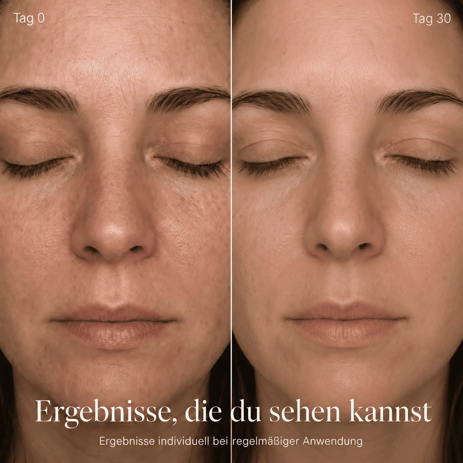 Glow One – Rotlichttherapie für Gesicht & Hals - Bild 7